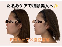 ナースリフェイス(Nurse Reface)/横顔美人に