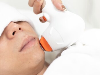 モアナ(Moana)/「ひげ脱毛」＃脱毛＃メンズ脱毛