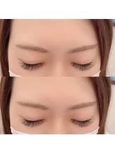 エン(EN)/マツエクでボリュームまつ毛