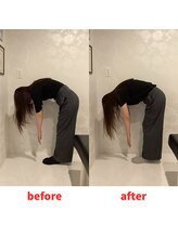 ナオル整体 福岡香椎院(NAORU整体)/20代女性施術事例【腰の痛み】