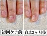 【３ヶ月で卒業！自爪育成】噛み爪・深爪・チビ爪を３ヶ月で美爪に！￥6,050