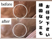 サロン ドロップ 上小田井(Salon drop)/「シミ改善」