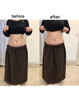 ジョワイユ(Joyeux)/腸の位置でお腹は変わる