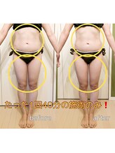 エステサロン 凛/ハイパーナイフのbefore&after