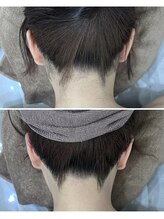 ミース 京都駅前店/うなじビフォーアフター