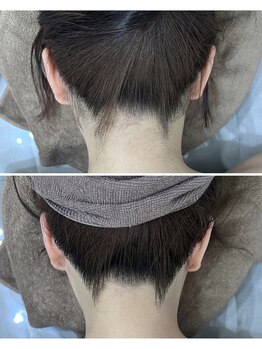 ミース 京都駅前店/うなじビフォーアフター