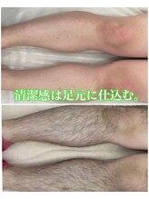 エリクサー 太田店(Elixir)/足脱毛