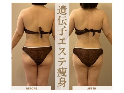 エーシーサロン 六本木店(acsalon)の写真