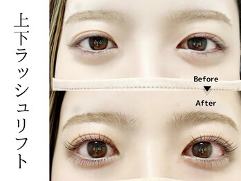 アイビューティー エピ(EyeBeauty epi)/小顔効果☆上下ラッシュリフト