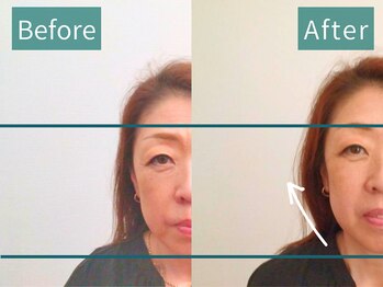 カンワ美容鍼灸院(KANWA美容鍼灸院)/50代女性美容鍼