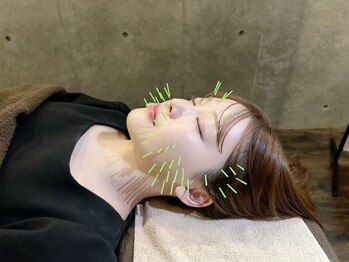 クリアランス 南青山(CLEARANCE)の写真/【芸能人が通う本格美容鍼】第一印象が劇的変化！垢抜け実現。痛みの感じにくい施術だから初めての方にも◎
