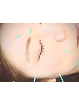 お肌をきれいにしたい