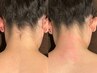 【女性限定】うなじWAX脱毛