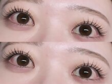 フィールリファイン(Feel Refine)