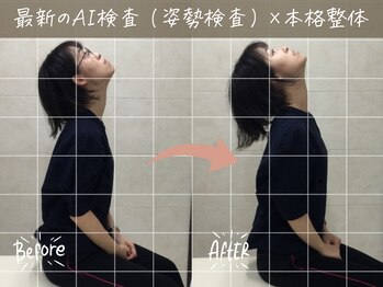 ナオル整体 町田院(NAORU整体)/before/after【5】 町田/整体