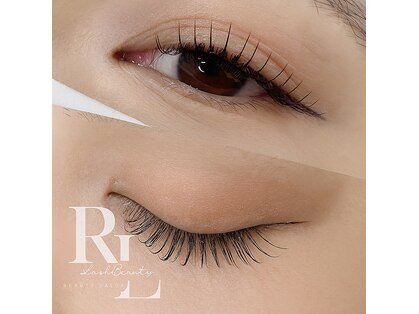 アールエル(RL)の写真