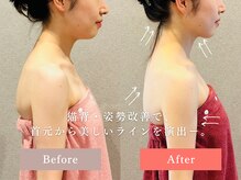 【小顔コルギ】は、ヘッド,背中,首肩,二の腕と上半身からケア♪