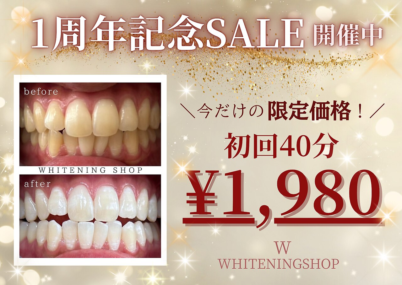 ホワイトニングショップ 上田店｜ホットペッパービューティー