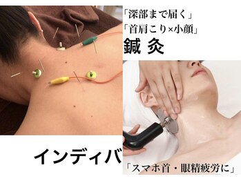 フィットジユウガオカ(Fit_Jiyugaoka)/辛い首肩こりにインディバと鍼灸