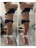 【人気No.1頑固な脂肪に】全身オーダー脂肪燃焼、即効サイズダウン￥22000