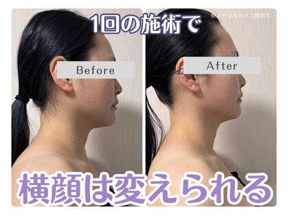 ルリアン(Lurian)の写真