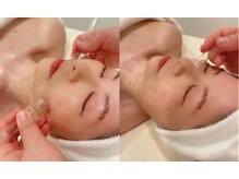 ポーラ 新所沢店(POLA)/毛穴吸引・リンパドレナージュ
