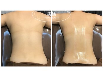 美極 銀座店/銀座/小顔コルギ/小顔矯正