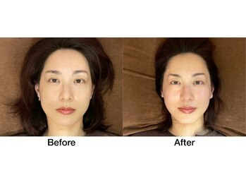 こじま 富雄団地接骨院/Before & After