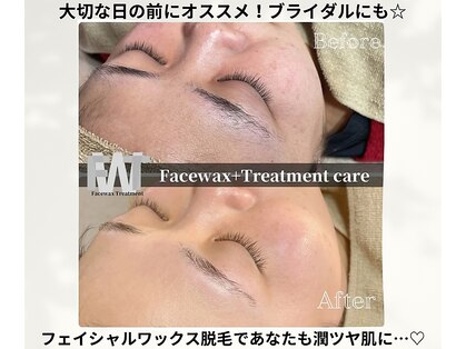 ヴィオラス(Violus)の写真