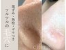 【毛穴プレミアムコース】黒ずみ除去＆開き改善◎毛穴洗浄＋引き締め生パック