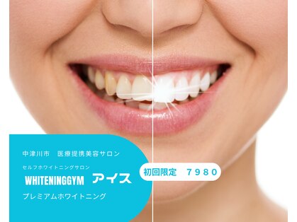 ホワイトニングジム アイスの写真