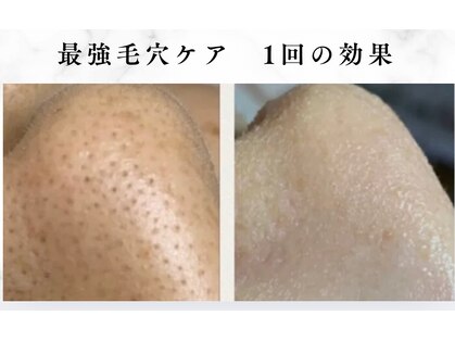 サロンドエクラ 南堀江(salon de eclat)の写真