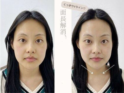 センガン(SENGAN)の写真