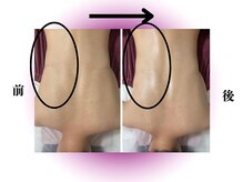 カリアンヌ/温活リンパマッサージ/保湿