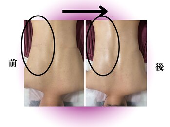 カリアンヌ/温活リンパマッサージ/保湿