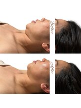 マヌレニ(manuleni)/二重顎の原因はコリだった！？