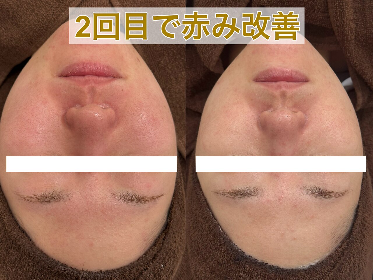 テンニック(10nick)｜ホットペッパービューティー