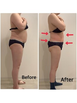 スペチアーレ 夙川/高額マシンばかり贅沢に使用