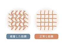 痛み不調専門整体 GymNat/筋膜イメージ