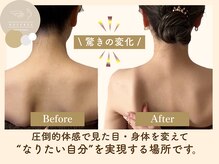 ラフリー 武蔵小杉院(RUFFREE)/筋膜リリースで肩こり猫背を撃退