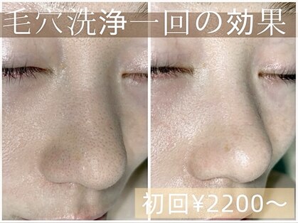 ベルミュー(Bell Miu)の写真