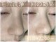 ベルミュー(Bell Miu)の写真