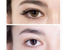 オールフォーユー(All for You)/フラットラッシュ付け放題