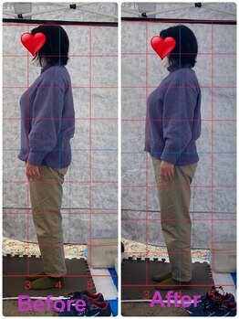 カイロプラクティック コダマ(KODAMA)/姿勢矯正ビフォーアフター