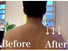 小顔屋ゆらやぎ/レタッチフェイス