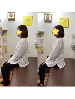 ヒデ整体院(Hide整体院)/首こり肩こり猫背巻き肩骨盤矯正