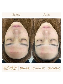 アモール 丸亀店(Amor)/眉毛/まつげパーマ/毛穴/脱毛