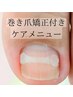 【巻き爪矯正希望の方はこちらから】8500円～12000円