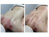 【リセット体験かっさ】だる重お疲れ背中に、30分で驚きのスッキリ感