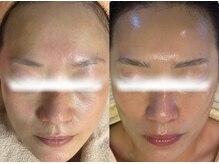 ルミア(LUMIA)/年齢肌×お悩み肌に結果重視ケア